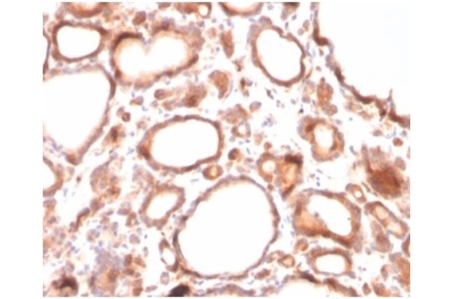 Immunohistochemistry - Anti-Calcitonin Antibody [CALCA/3310] - BSA and Azide free (A278417) - Antibodies.com