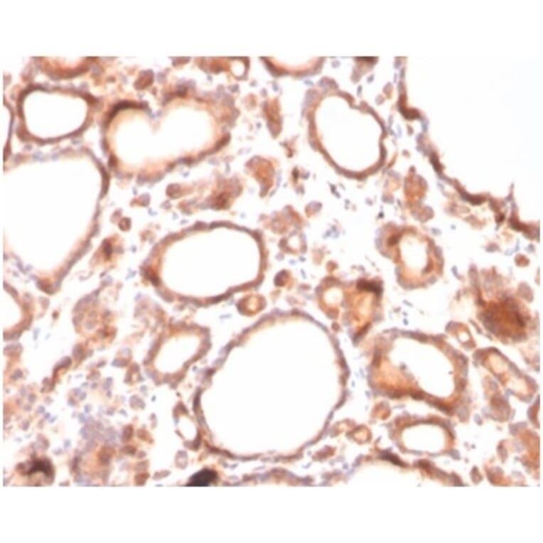 Immunohistochemistry - Anti-Calcitonin Antibody [CALCA/3310] - BSA and Azide free (A278417) - Antibodies.com