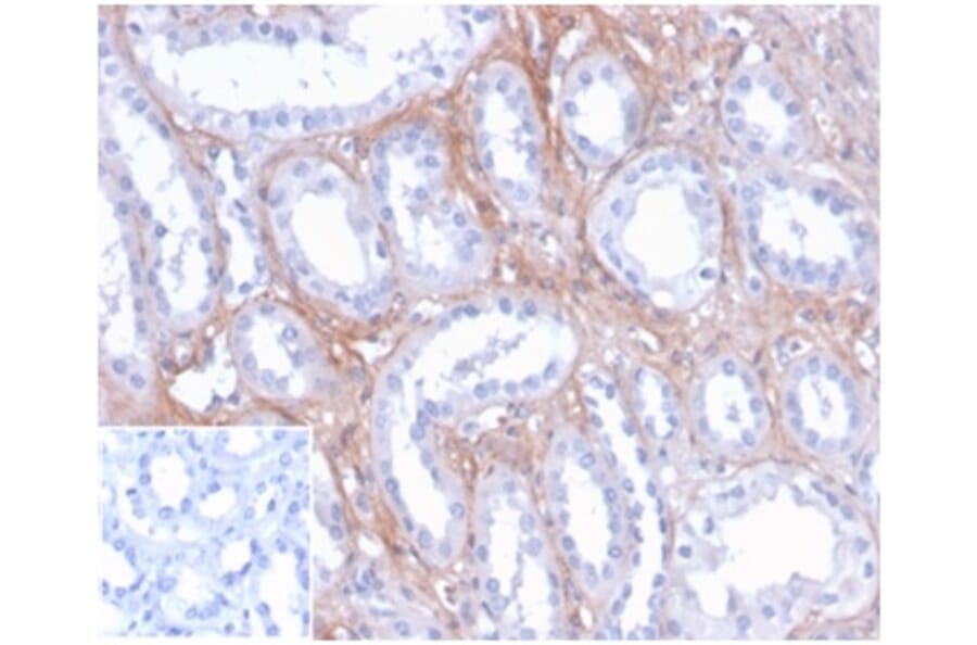 Immunohistochemistry - Anti-FGF23 Antibody [FGF23/4171] - BSA and Azide free (A278418) - Antibodies.com