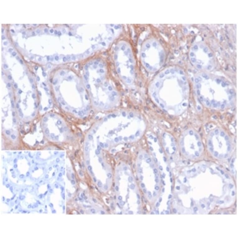Immunohistochemistry - Anti-FGF23 Antibody [FGF23/4171] - BSA and Azide free (A278418) - Antibodies.com