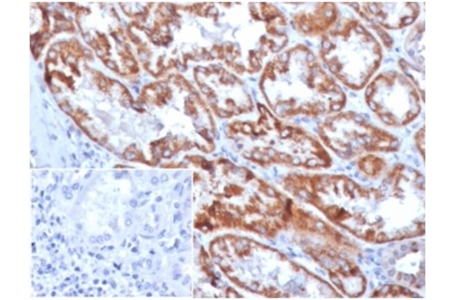 Immunohistochemistry - Anti-FGF23 Antibody [FGF23/4169] - BSA and Azide free (A278420) - Antibodies.com