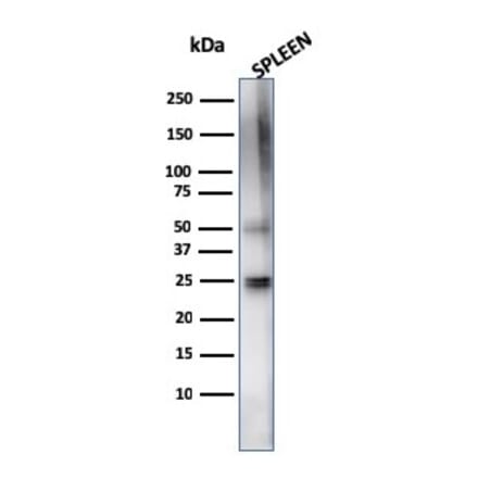 Western Blot - Anti-TIM3 Antibody [TIM3/4024] - BSA and Azide free (A278421) - Antibodies.com