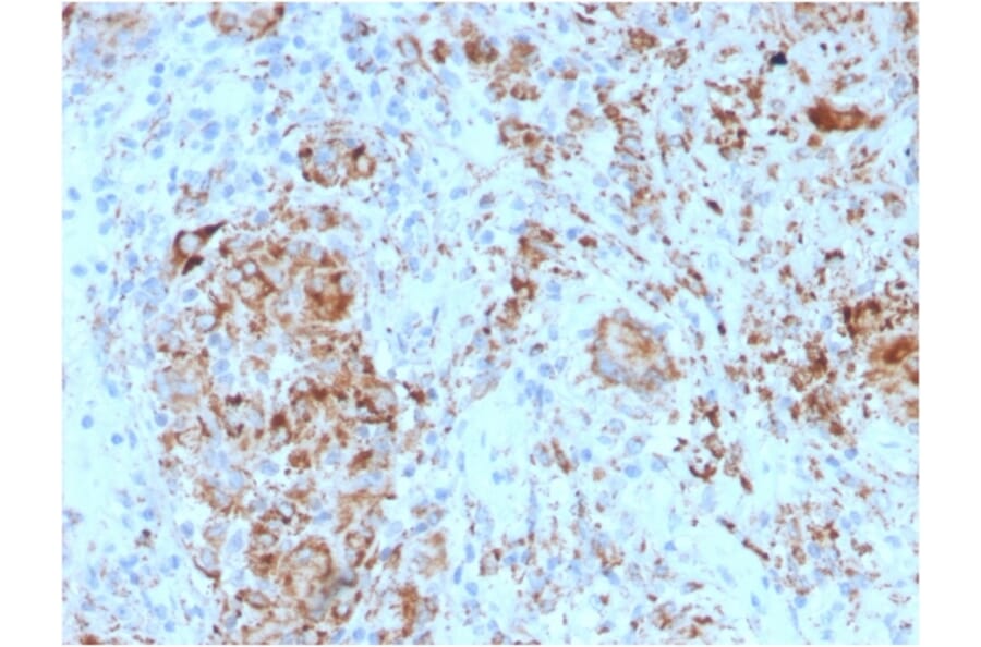 Immunohistochemistry - Anti-TIM3 Antibody [TIM3/4024] - BSA and Azide free (A278421) - Antibodies.com