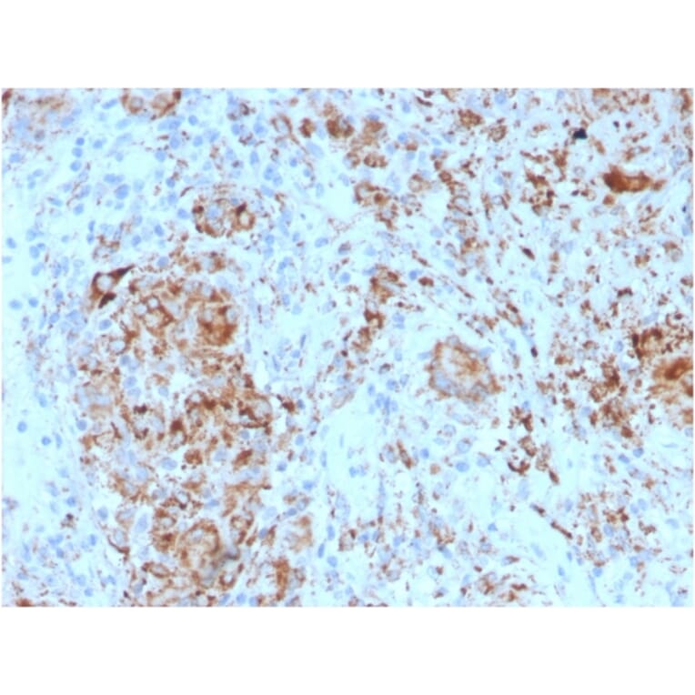 Immunohistochemistry - Anti-TIM3 Antibody [TIM3/4024] - BSA and Azide free (A278421) - Antibodies.com