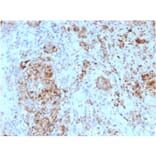 Immunohistochemistry - Anti-TIM3 Antibody [TIM3/4024] - BSA and Azide free (A278421) - Antibodies.com