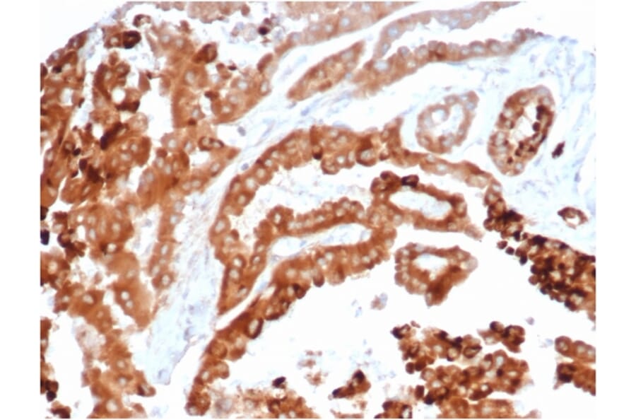 Immunohistochemistry - Anti-TIM3 Antibody [TIM3/4024] - BSA and Azide free (A278421) - Antibodies.com