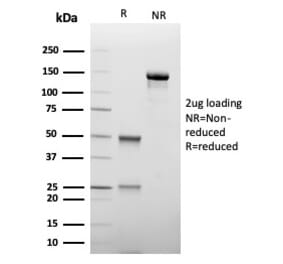 SDS-PAGE - Anti-TIM3 Antibody [TIM3/4027] - BSA and Azide free (A278422) - Antibodies.com