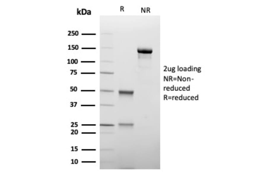 SDS-PAGE - Anti-TIM3 Antibody [TIM3/4027] - BSA and Azide free (A278422) - Antibodies.com