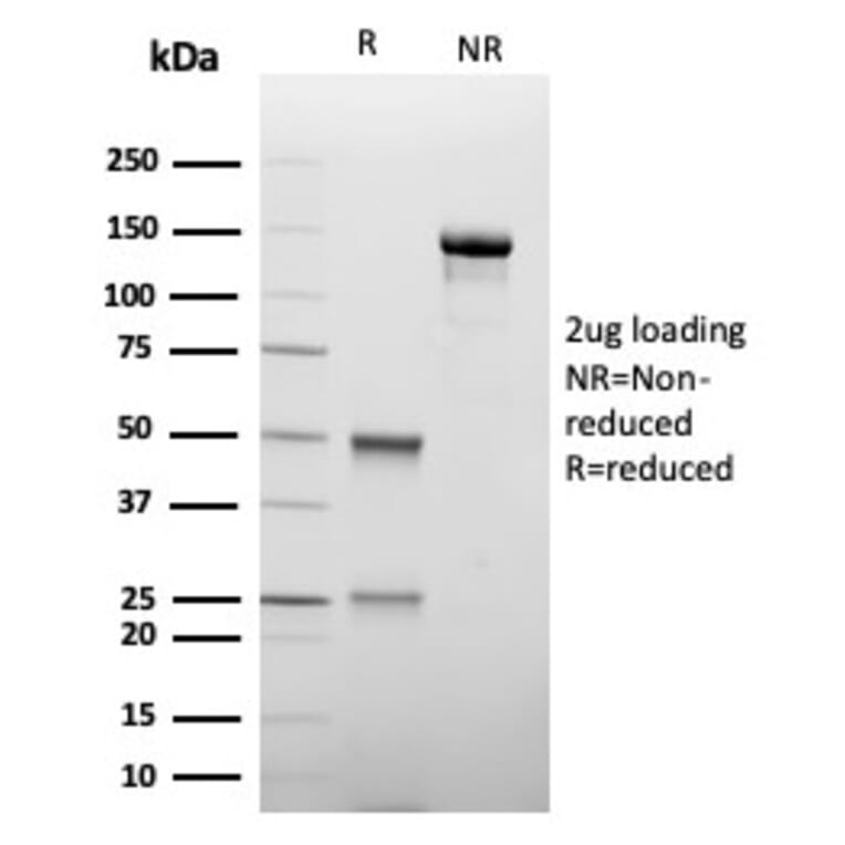 SDS-PAGE - Anti-TIM3 Antibody [TIM3/4027] - BSA and Azide free (A278422) - Antibodies.com