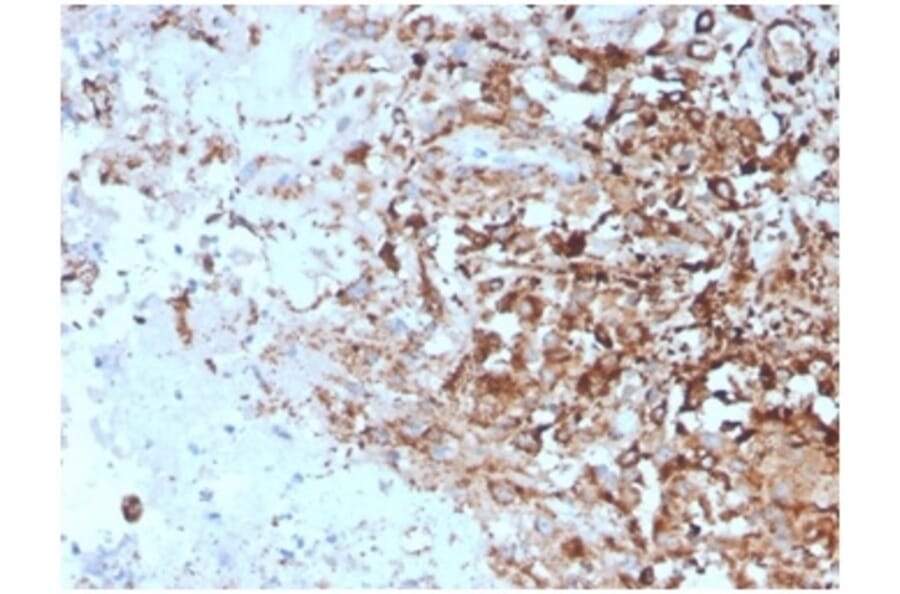 Immunohistochemistry - Anti-TIM3 Antibody [TIM3/4027] - BSA and Azide free (A278422) - Antibodies.com