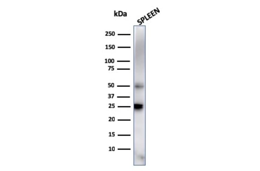Western Blot - Anti-TIM3 Antibody [TIM3/4027] - BSA and Azide free (A278422) - Antibodies.com