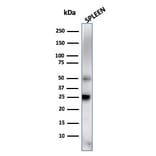 Western Blot - Anti-TIM3 Antibody [TIM3/4027] - BSA and Azide free (A278422) - Antibodies.com