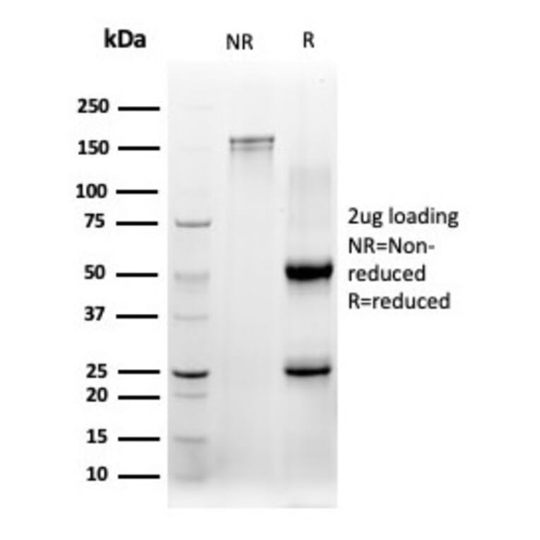 SDS-PAGE - Anti-CBFB Antibody [PCRP-CBFB-1F6] - BSA and Azide free (A278424) - Antibodies.com