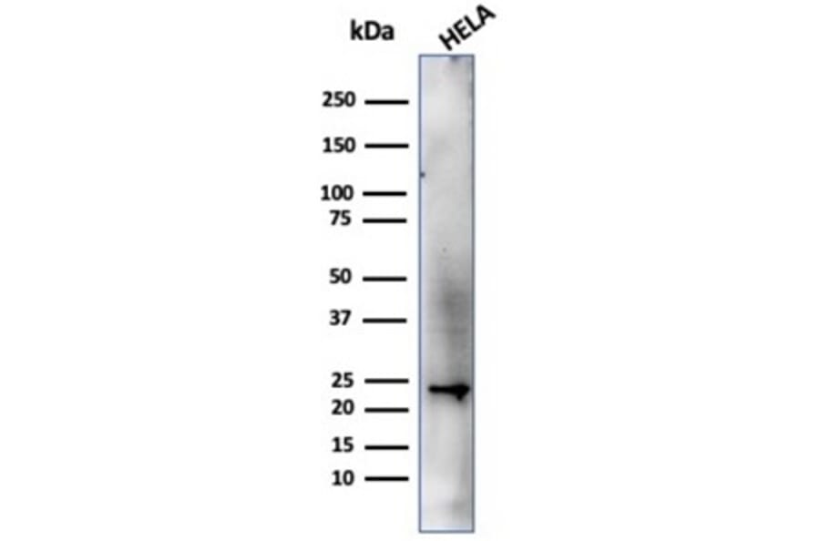 Western Blot - Anti-CBFB Antibody [PCRP-CBFB-1F6] - BSA and Azide free (A278424) - Antibodies.com