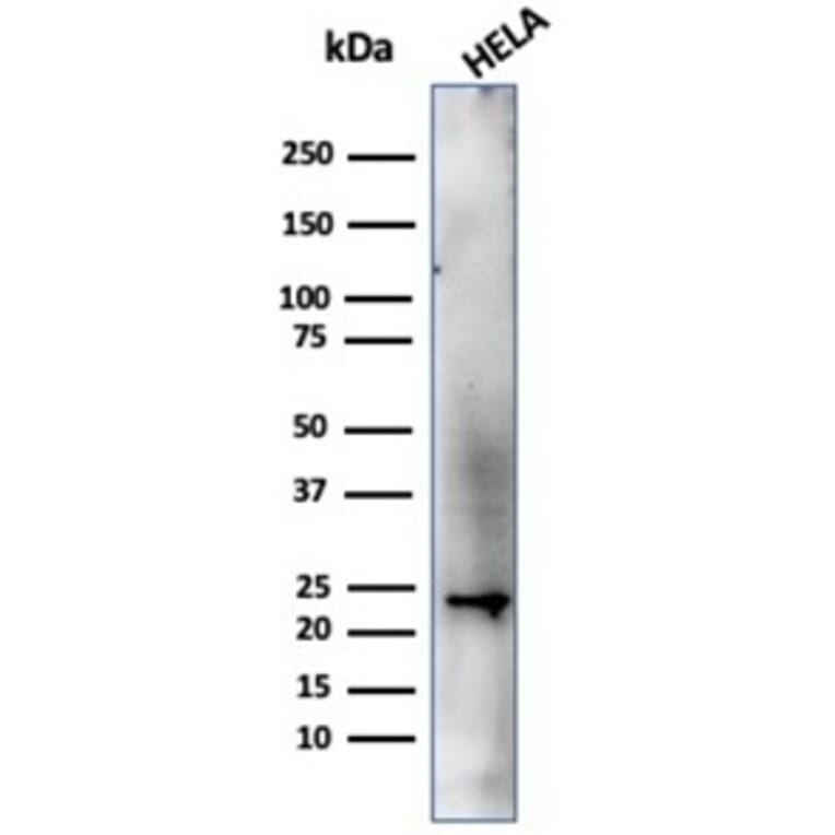 Western Blot - Anti-CBFB Antibody [PCRP-CBFB-1F6] - BSA and Azide free (A278424) - Antibodies.com