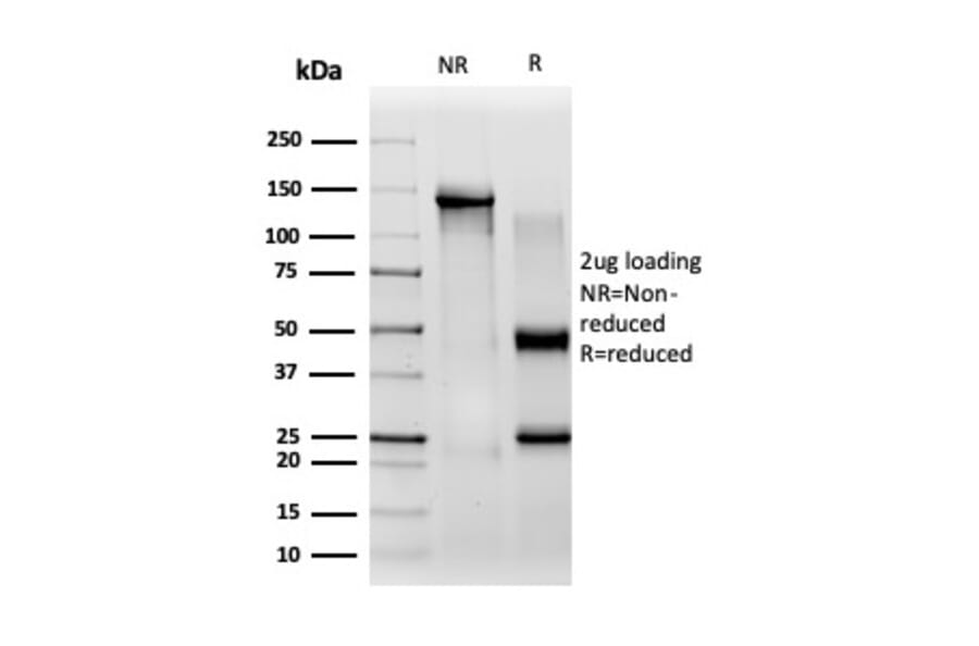 SDS-PAGE - Anti-CBFB Antibody [PCRP-CBFB-1E6] - BSA and Azide free (A278425) - Antibodies.com
