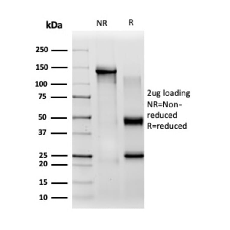 SDS-PAGE - Anti-CBFB Antibody [PCRP-CBFB-1E6] - BSA and Azide free (A278425) - Antibodies.com