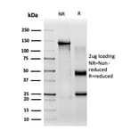 SDS-PAGE - Anti-CBFB Antibody [PCRP-CBFB-1E6] - BSA and Azide free (A278425) - Antibodies.com