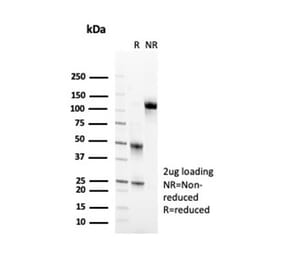 SDS-PAGE - Anti-CD2 Antibody [LFA2/7102] - BSA and Azide free (A278428) - Antibodies.com