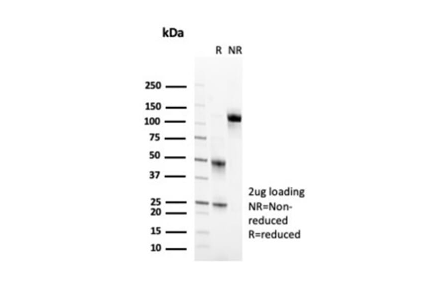 SDS-PAGE - Anti-CD2 Antibody [LFA2/7102] - BSA and Azide free (A278428) - Antibodies.com