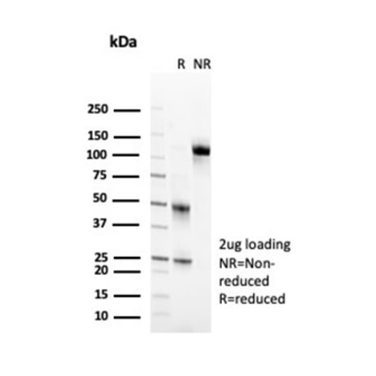 SDS-PAGE - Anti-CD2 Antibody [LFA2/7102] - BSA and Azide free (A278428) - Antibodies.com
