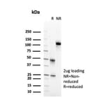 SDS-PAGE - Anti-CD2 Antibody [LFA2/7102] - BSA and Azide free (A278428) - Antibodies.com