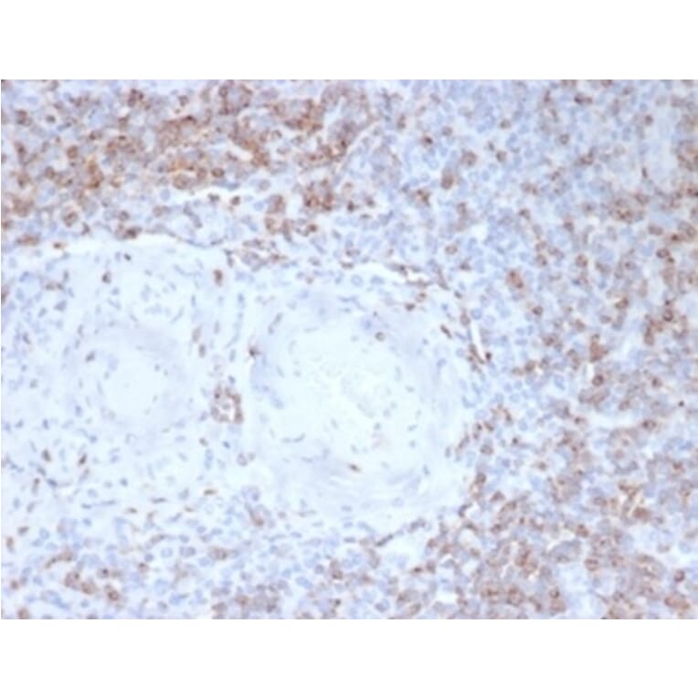 Immunohistochemistry - Anti-CD2 Antibody [LFA2/7102] - BSA and Azide free (A278428) - Antibodies.com