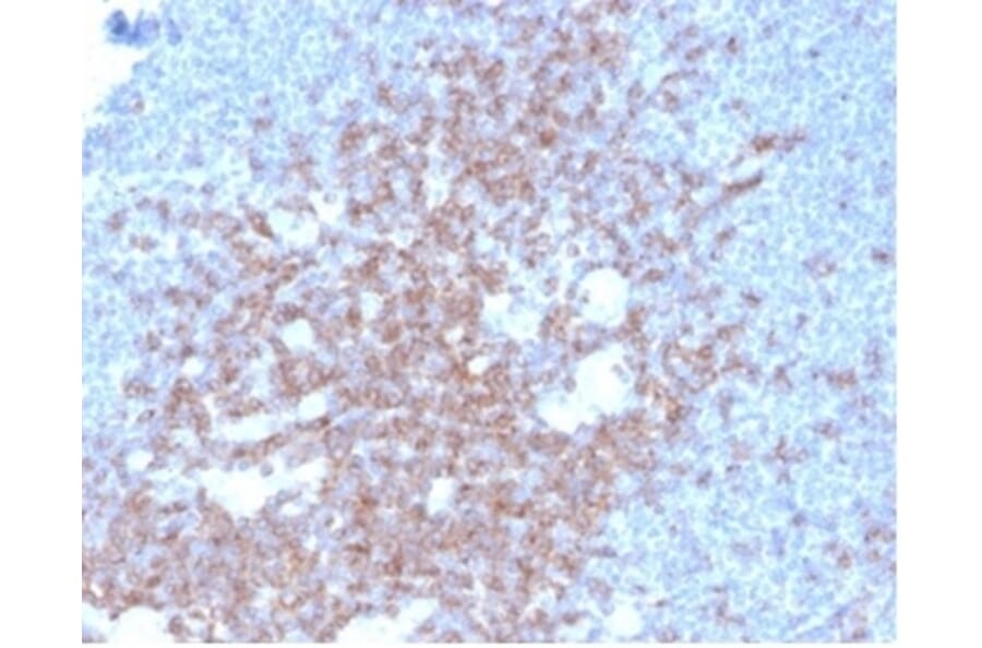 Immunohistochemistry - Anti-CD2 Antibody [LFA2/7102] - BSA and Azide free (A278428) - Antibodies.com
