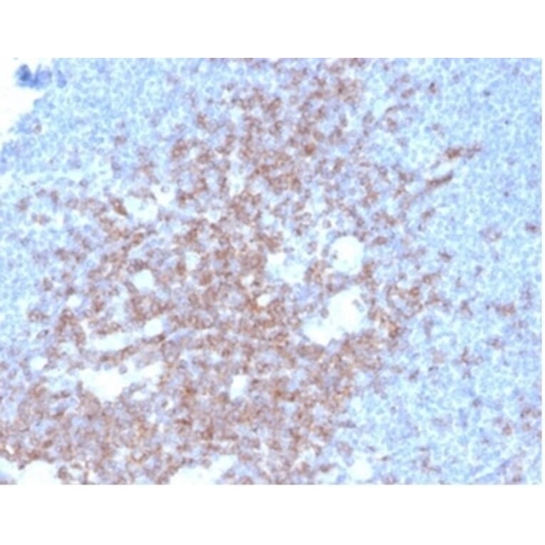 Immunohistochemistry - Anti-CD2 Antibody [LFA2/7102] - BSA and Azide free (A278428) - Antibodies.com