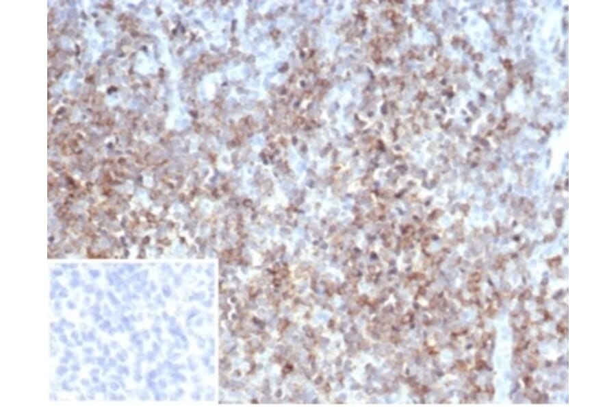 Immunohistochemistry - Anti-CD2 Antibody [LFA2/7102] - BSA and Azide free (A278428) - Antibodies.com