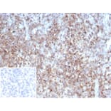 Immunohistochemistry - Anti-CD2 Antibody [LFA2/7102] - BSA and Azide free (A278428) - Antibodies.com