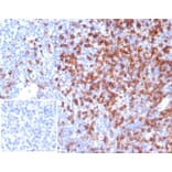 Immunohistochemistry - Anti-CD4 Antibody [CD4/7142] - BSA and Azide free (A278429) - Antibodies.com