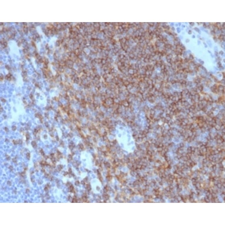 Immunohistochemistry - Anti-CD4 Antibody [CD4/7142] - BSA and Azide free (A278429) - Antibodies.com