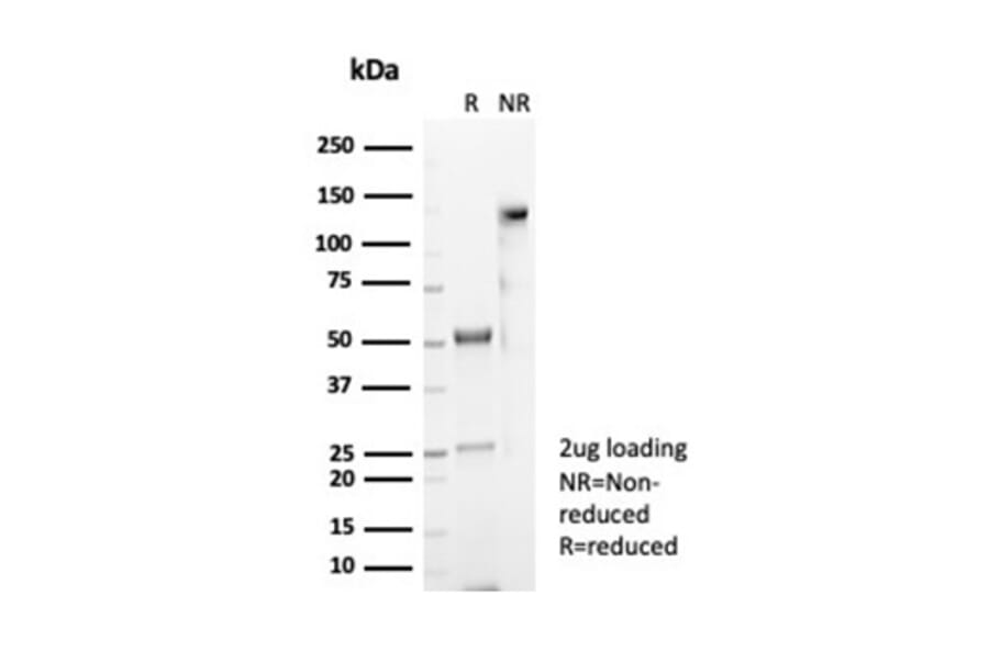 SDS-PAGE - Anti-CD4 Antibody [CD4/7144] - BSA and Azide free (A278430) - Antibodies.com