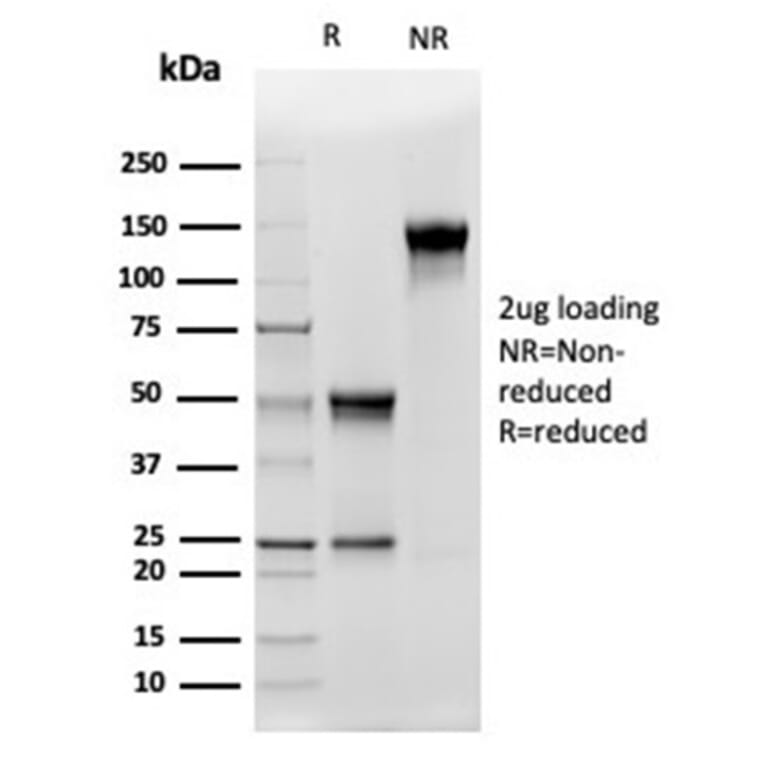 SDS-PAGE - Anti-CD5L Antibody [CD5L/4420] - BSA and Azide free (A278431) - Antibodies.com