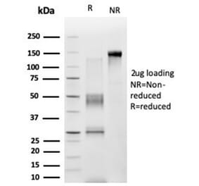 SDS-PAGE - Anti-ZNF276 Antibody [PCRP-ZNF276-1A5] - BSA and Azide free (A278433) - Antibodies.com