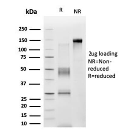 SDS-PAGE - Anti-ZNF276 Antibody [PCRP-ZNF276-1A5] - BSA and Azide free (A278433) - Antibodies.com