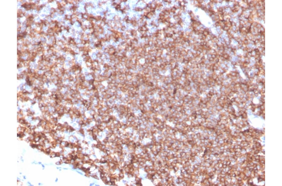 Immunohistochemistry - Anti-CD20 Antibody [MS4A1/4655] - BSA and Azide free (A278434) - Antibodies.com
