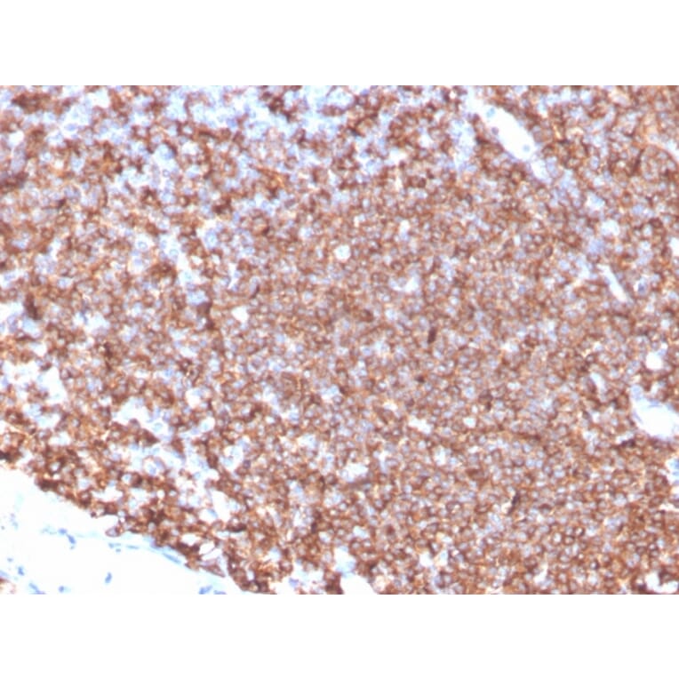 Immunohistochemistry - Anti-CD20 Antibody [MS4A1/4655] - BSA and Azide free (A278434) - Antibodies.com