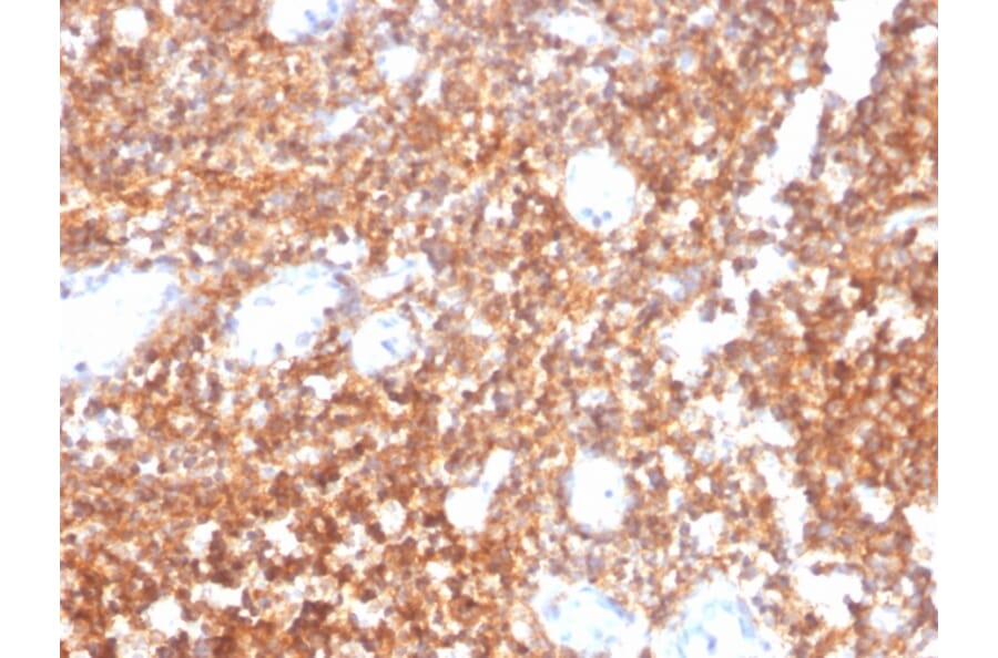 Immunohistochemistry - Anti-CD20 Antibody [MS4A1/4655] - BSA and Azide free (A278434) - Antibodies.com