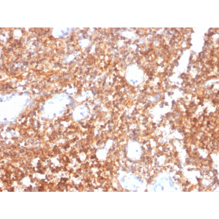 Immunohistochemistry - Anti-CD20 Antibody [MS4A1/4655] - BSA and Azide free (A278434) - Antibodies.com