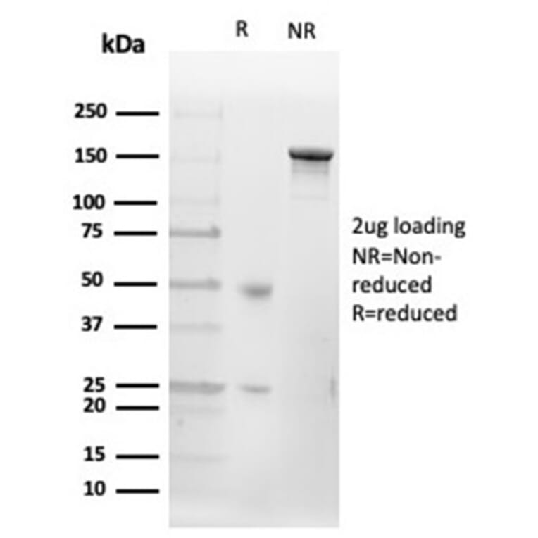 SDS-PAGE - Anti-CD20 Antibody [MS4A1/4655] - BSA and Azide free (A278434) - Antibodies.com