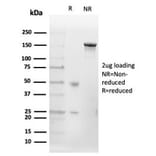 SDS-PAGE - Anti-CD20 Antibody [MS4A1/4655] - BSA and Azide free (A278434) - Antibodies.com