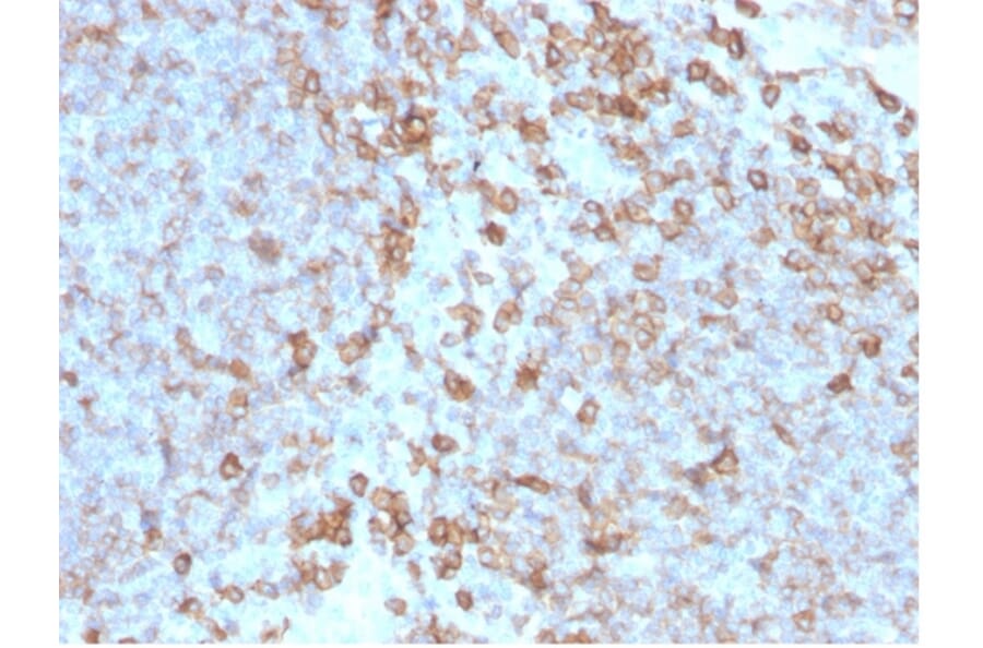 Immunohistochemistry - Anti-CD27 Antibody [LPFS2/4176] - BSA and Azide free (A278435) - Antibodies.com