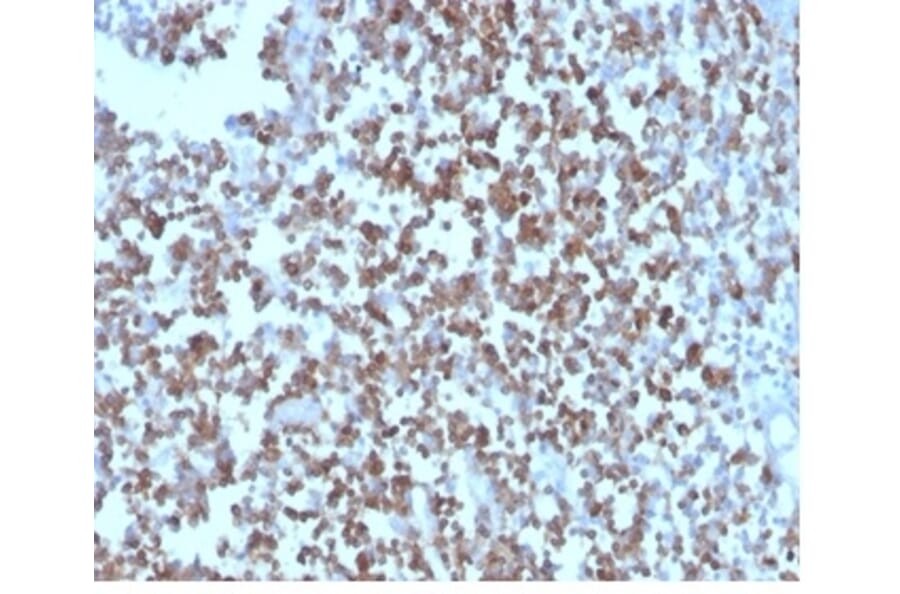 Immunohistochemistry - Anti-CD27 Antibody [LPFS2/4178] - BSA and Azide free (A278436) - Antibodies.com