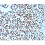 Immunohistochemistry - Anti-CD27 Antibody [LPFS2/4178] - BSA and Azide free (A278436) - Antibodies.com