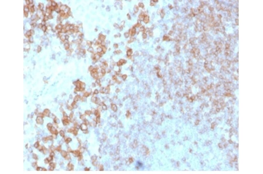 Immunohistochemistry - Anti-CD27 Antibody [LPFS2/4178] - BSA and Azide free (A278436) - Antibodies.com
