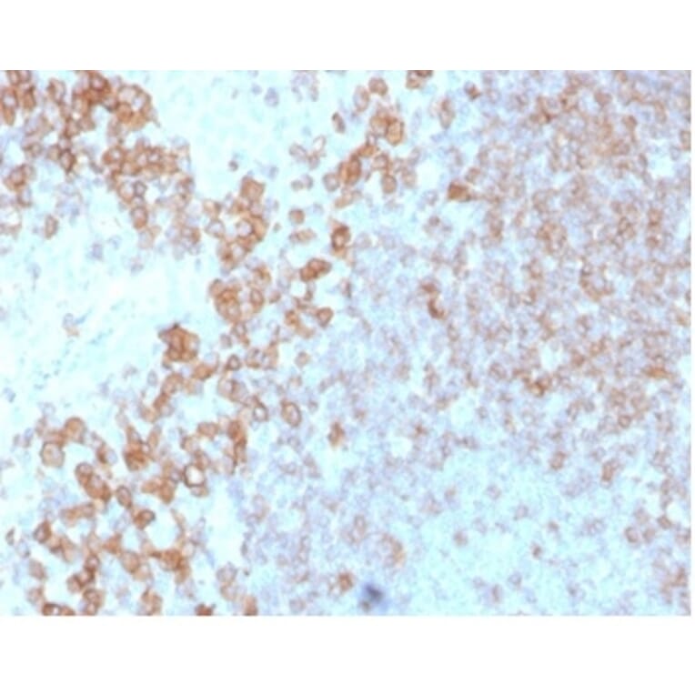 Immunohistochemistry - Anti-CD27 Antibody [LPFS2/4178] - BSA and Azide free (A278436) - Antibodies.com