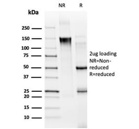 SDS-PAGE - Anti-MED21 Antibody [PCRP-MED21-4B5] - BSA and Azide free (A278437) - Antibodies.com