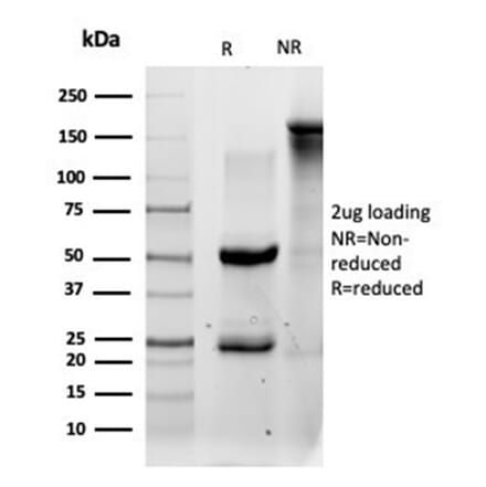SDS-PAGE - Anti-QKI Antibody [PCRP-QKI-2F10] - BSA and Azide free (A278440) - Antibodies.com